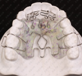 ZM-C-K定制式正畸擴弓矯治器