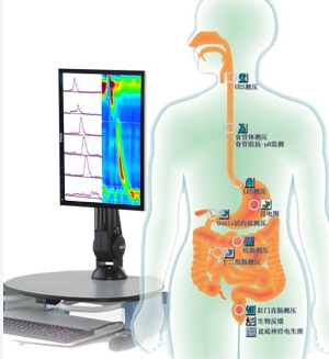 Solar GI 荷蘭MMS胃腸動力學檢查系統