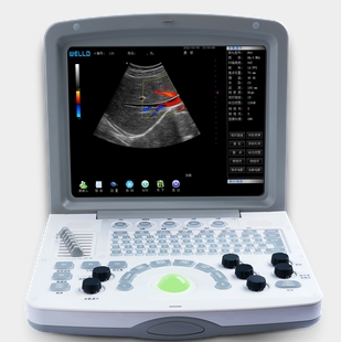 FDC6000 威爾德全數字彩色多普勒超聲診斷系統