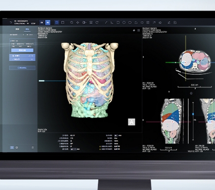 HyVision-3D 海杰亞肝臟CT圖像處理軟件