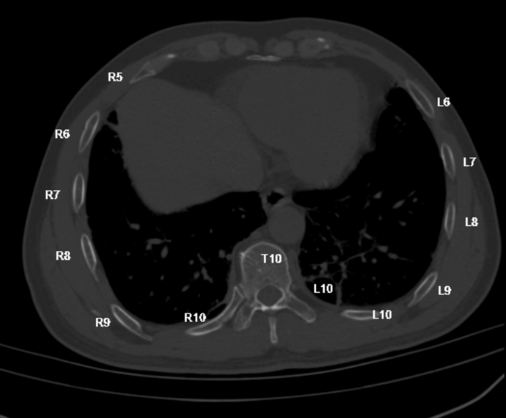 uIGS Spine 200 脊柱醫學影像處理軟件