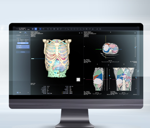 HY-CT-LIRADS 肝臟CT醫學影像存儲傳輸與處理軟件