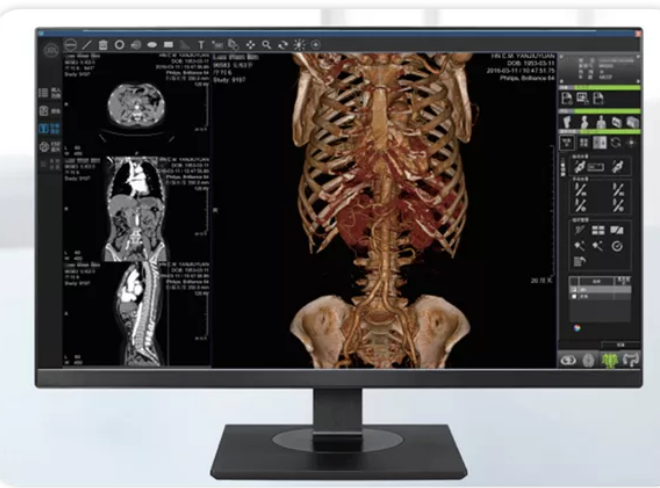 Tavigator 心臟醫學影像處理分析軟件