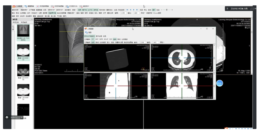 HINAMobileImageViewerV2.0 移動醫學影像存儲傳輸處理系統