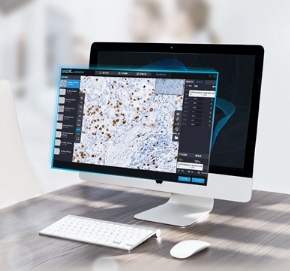 dInsight W胃組織病理圖像處理軟件迪英加