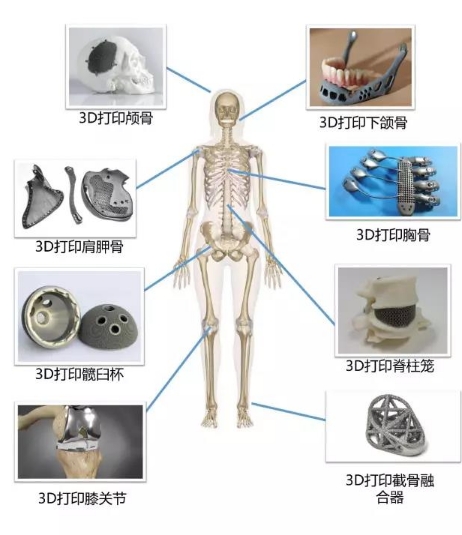 NL3D-XW01定制式3D打印人體醫(yī)學模型華翔