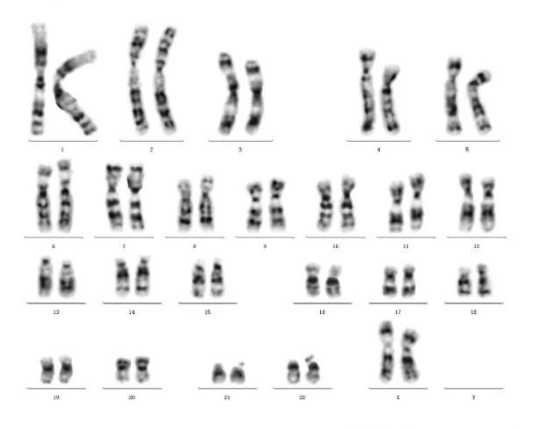 染色體核型分析軟件1.png
